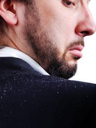 Beard Dandruff